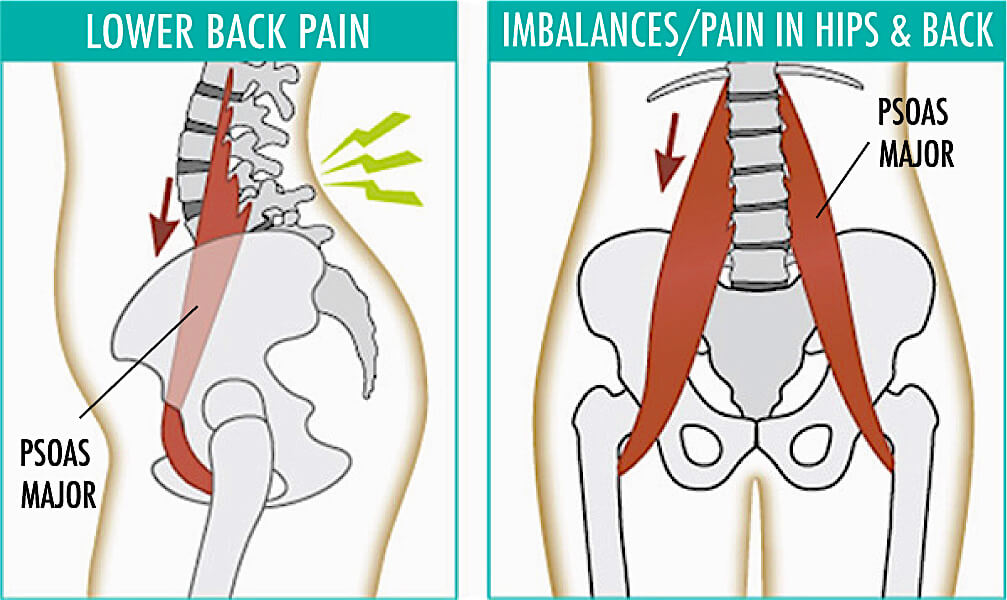 How Good Is Your Psoas Muscle?