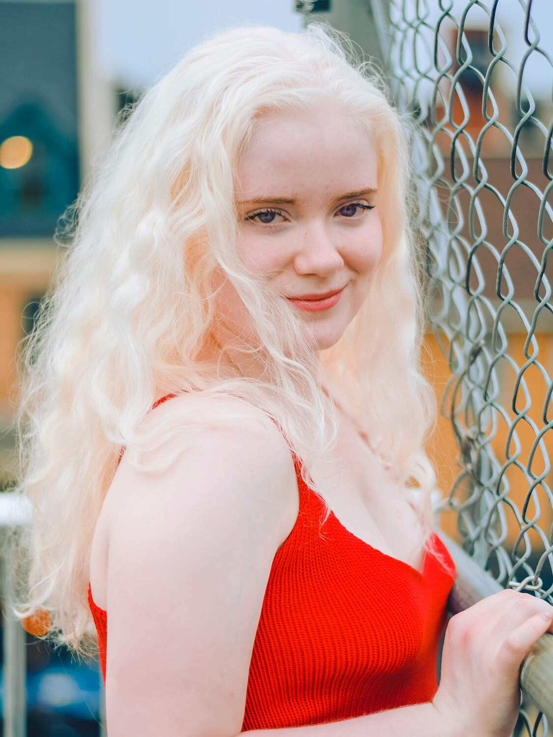 Girl with albinism stands beside a fence in the summer with red shirt