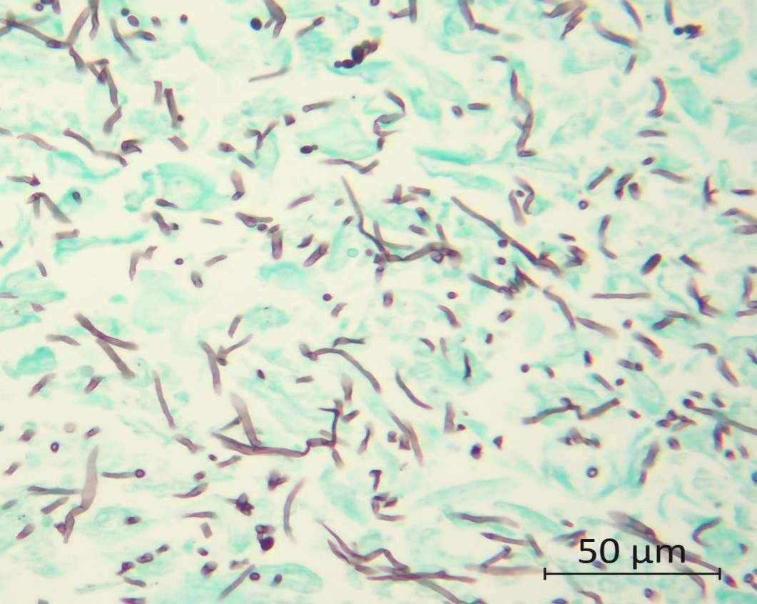 GMS Stain