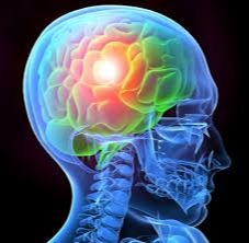 Physiotherapy Management of Traumatic Brain Injury